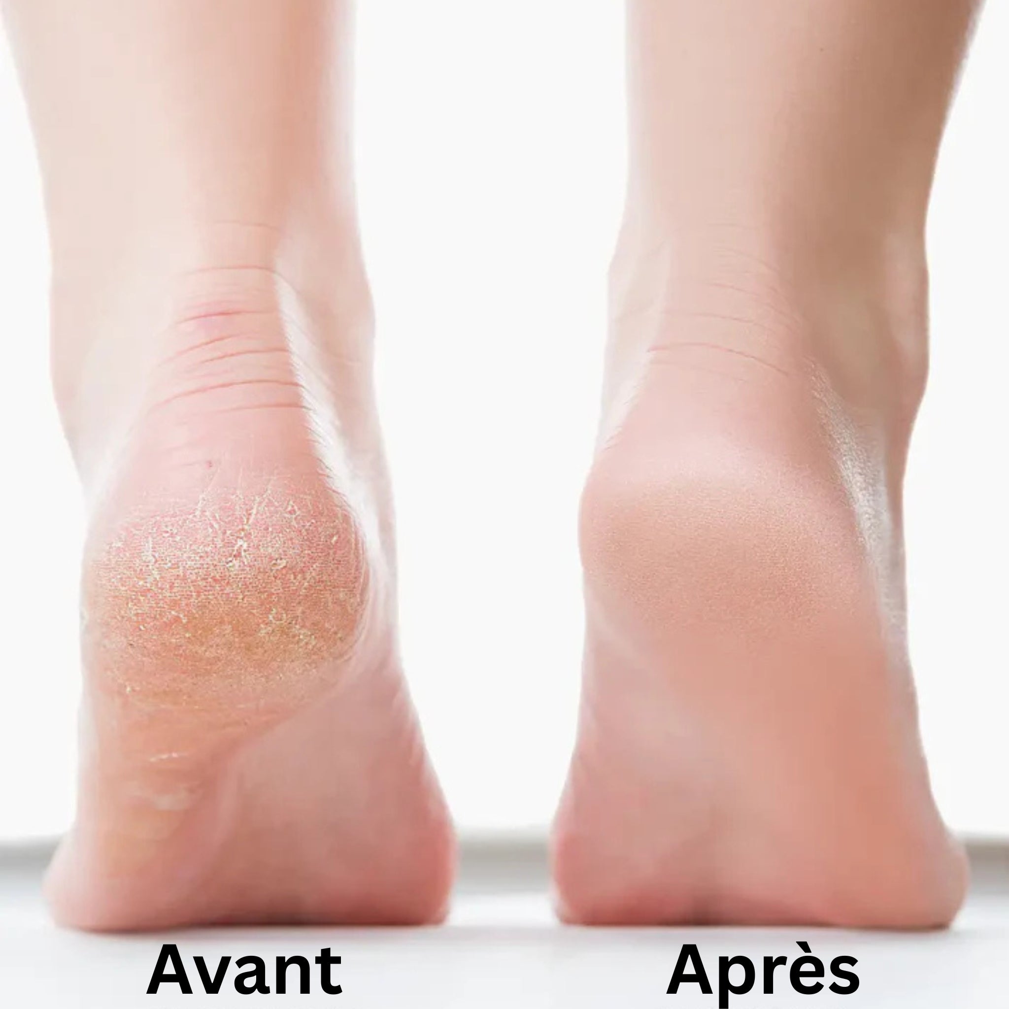 Jadea Glow Pro™ - Soin Prestige Pieds Velours