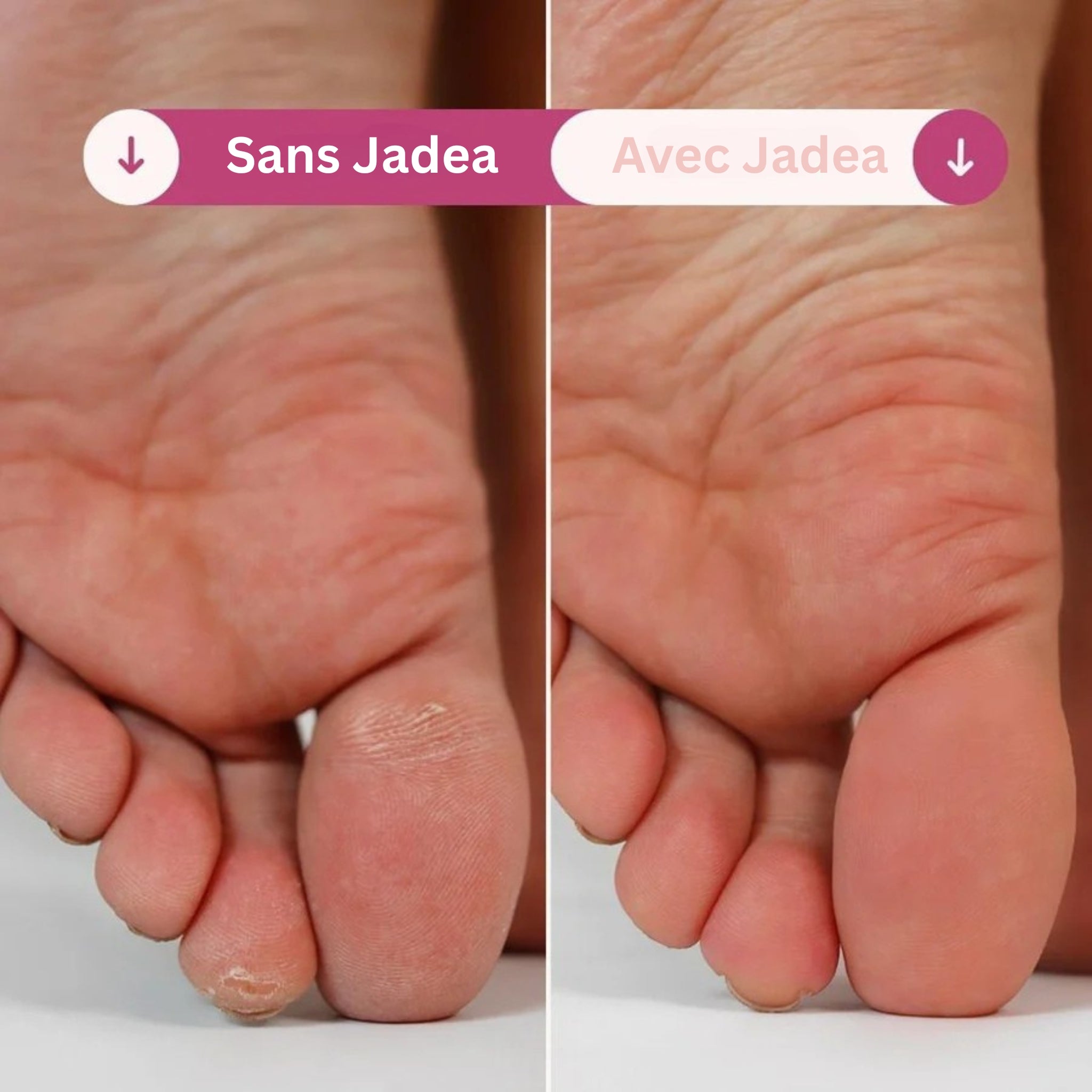 Jadea Glow Pro™ - Soin Prestige Pieds Velours